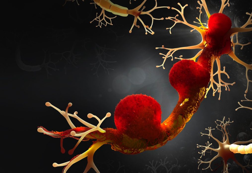 Rak ugrabi živčevje