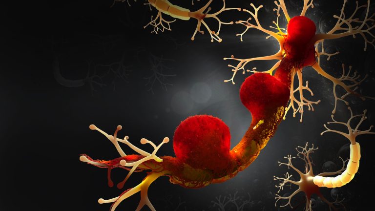 Rak ugrabi živčevje