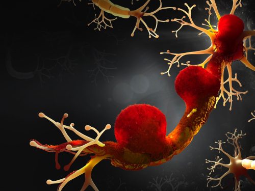 Rak ugrabi živčevje